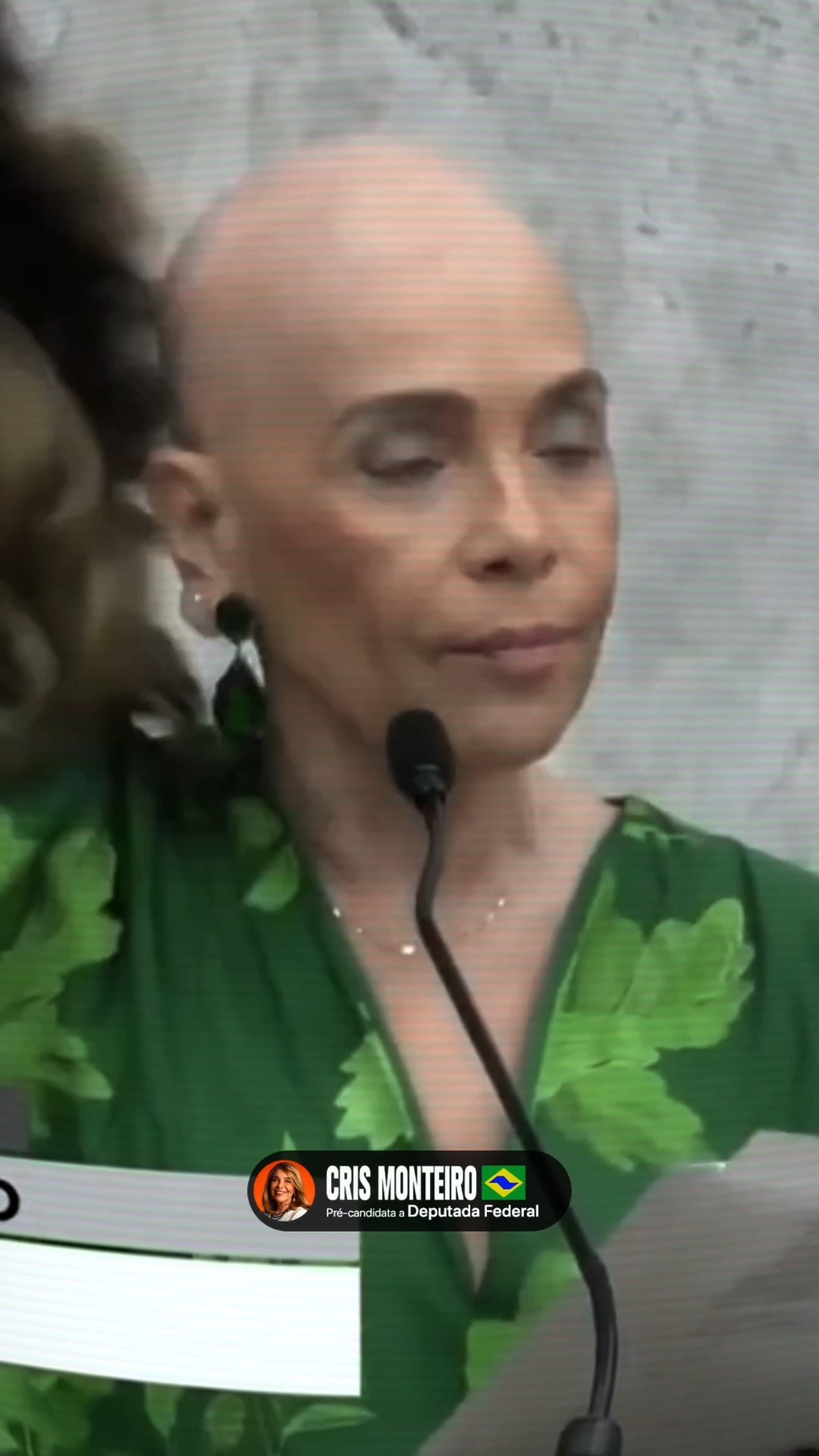 Ter alopecia é apenas uma característica minha. Sempre reagi aos desafios sem me vitimizar, mas sei…